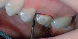 periodoncia