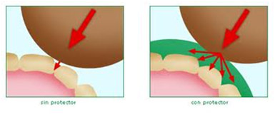Deportes de Riesgo en Odontología  y Férulas de Protección